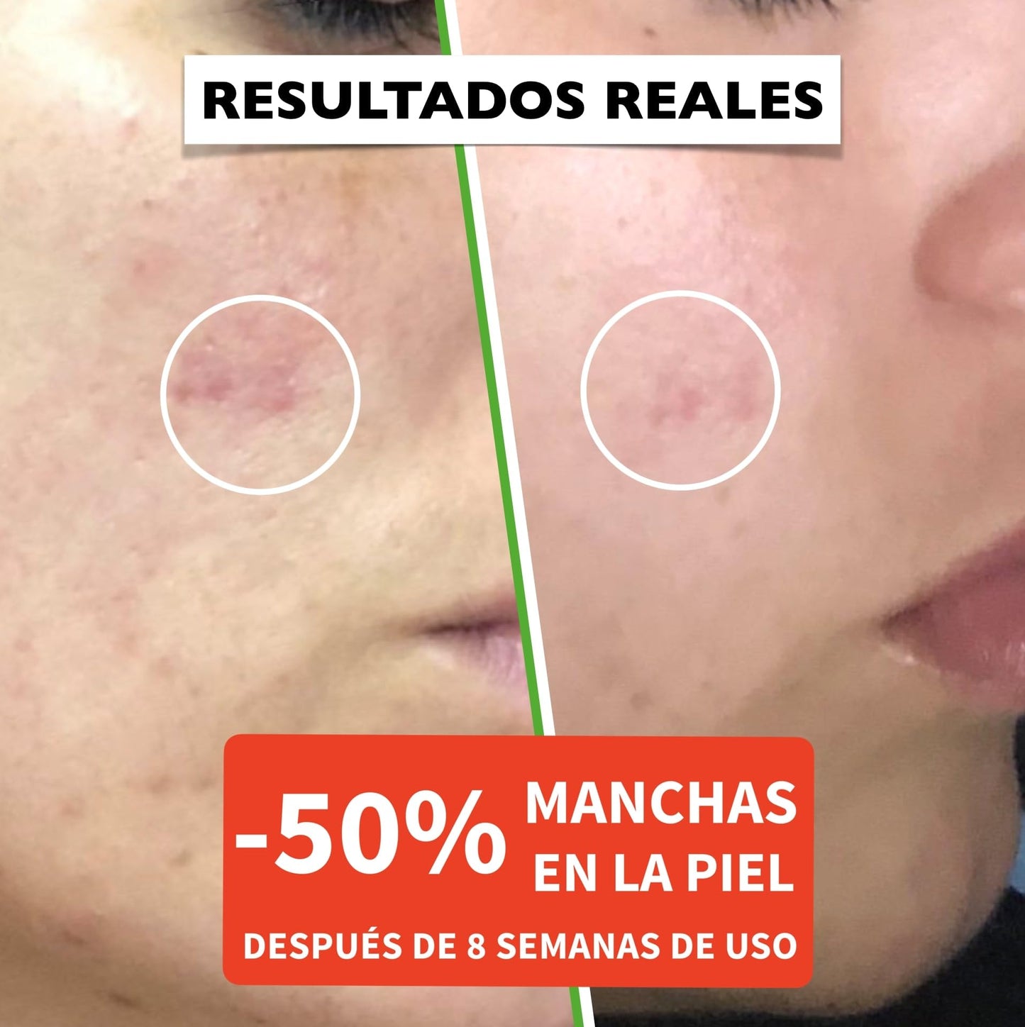 60ml. Bio Sérum Facial con Vitamina C, E y Ácido Hyalurónico. Suero Hidratante, Antiarrugas y Antimanchas para la Cara. Vegano/Organic. Crema Antiedad para Contorno de Ojos y Dermaroller